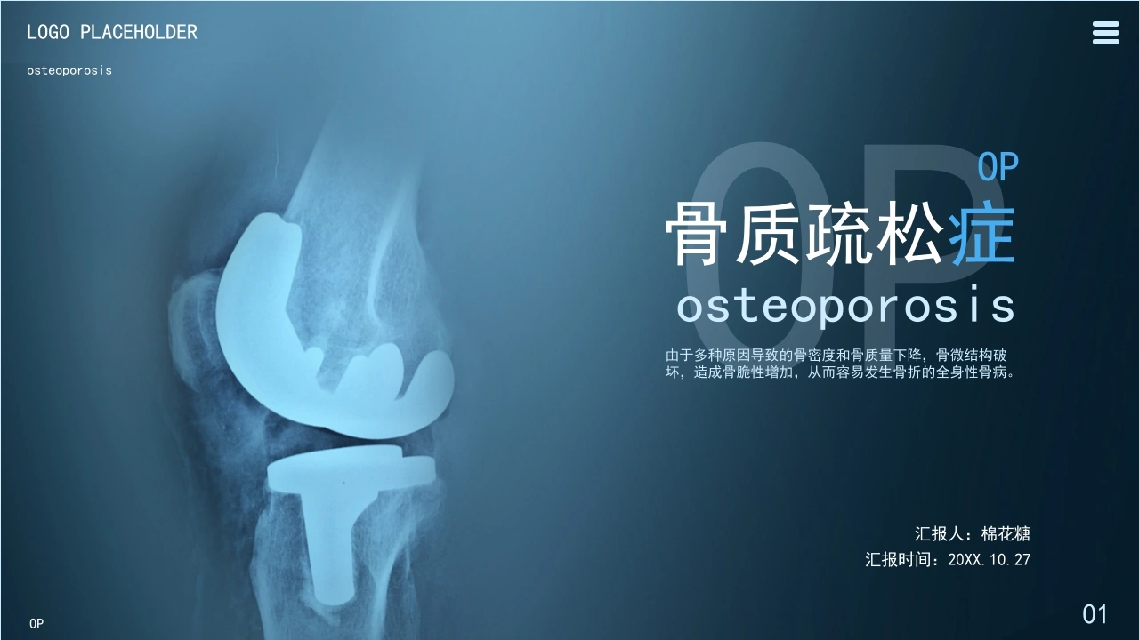 C098骨质疏松症PPT