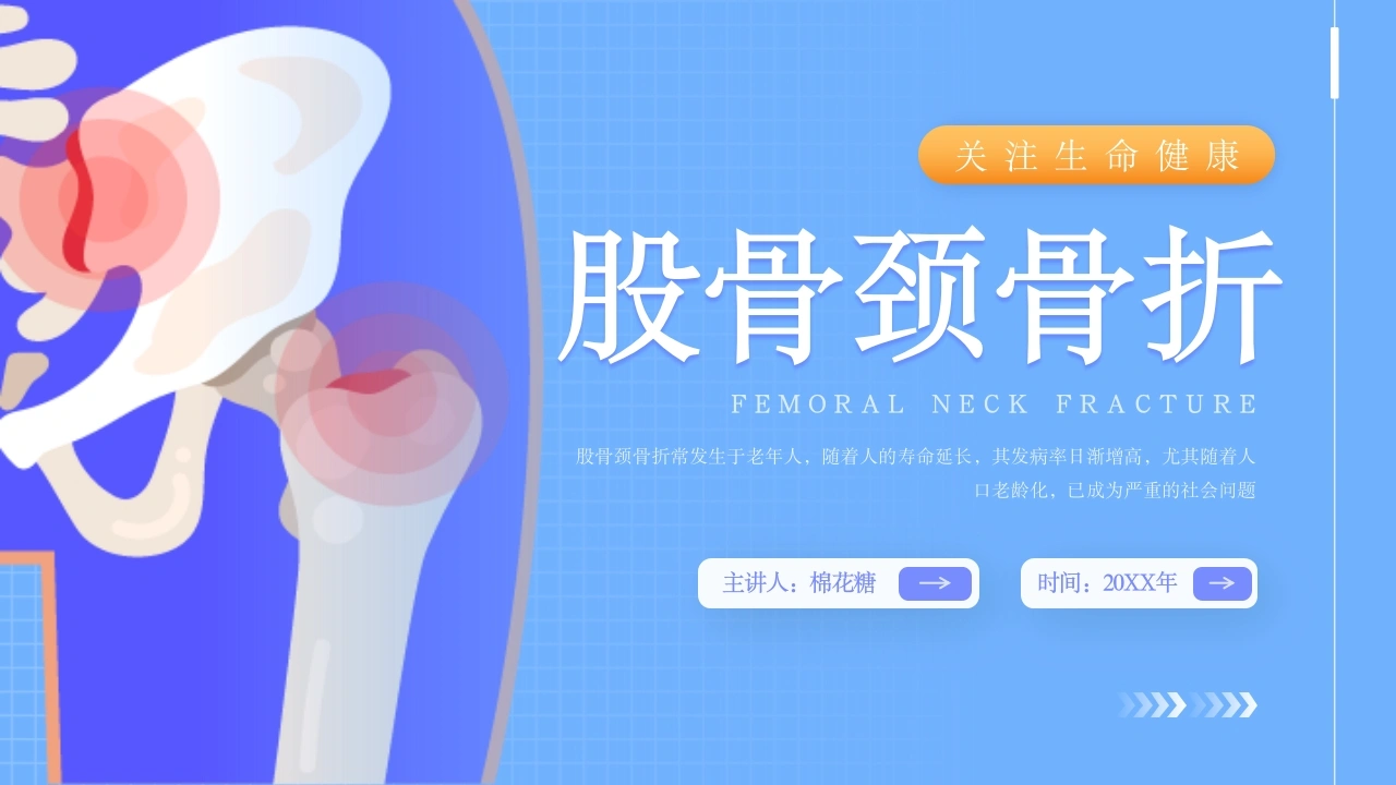 C330股骨颈骨折PPT-白衣资料网