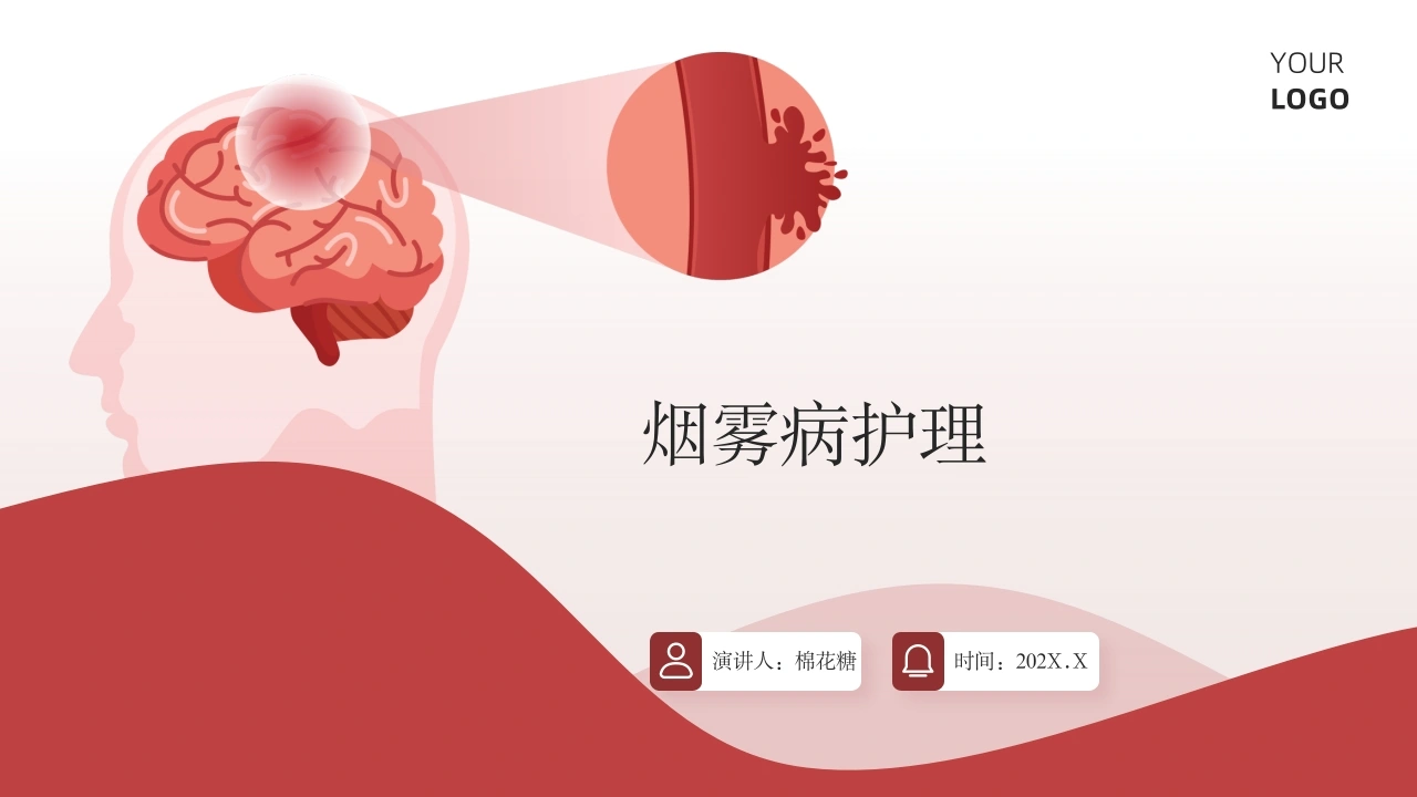C498烟雾病护理带参考文献PPT-白衣资料网