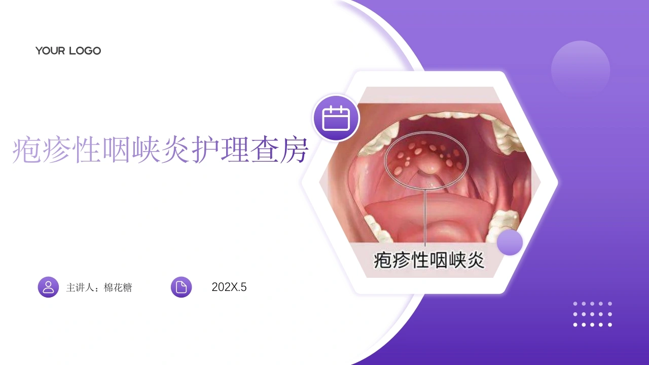 C536疱疹性咽峡炎护理查房带参考文献PPT-白衣资料网