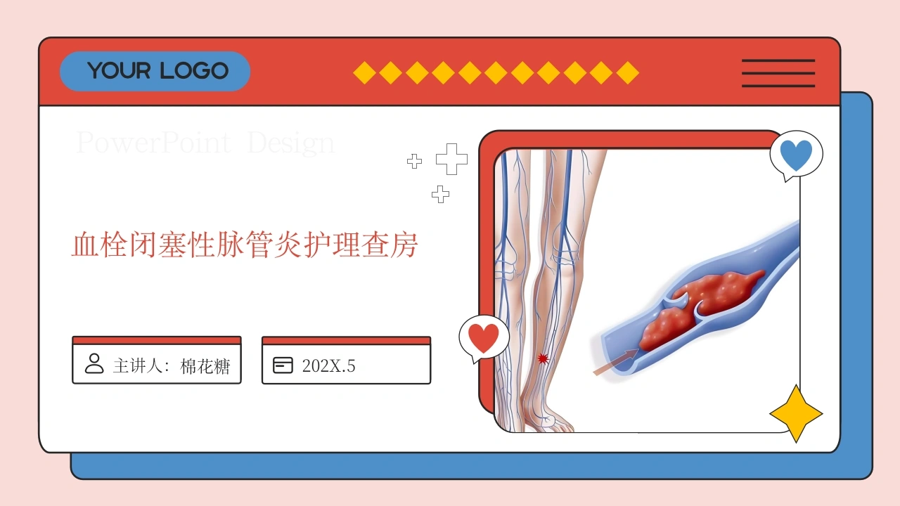 C566血栓闭塞性脉管炎护理查房带参考文献PPT-白衣资料网