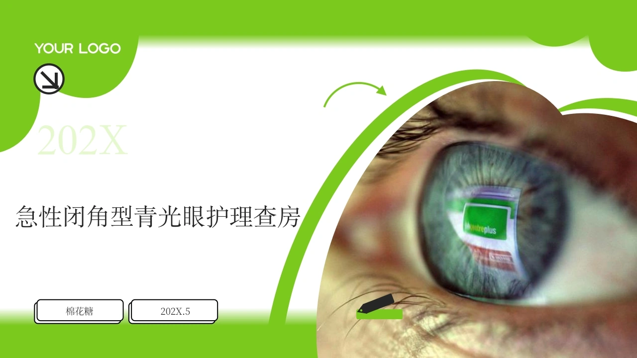 C572急性闭角型青光眼护理查房带参考文献PPT-白衣资料网