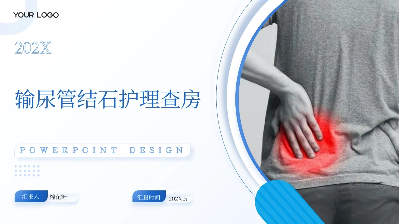 C582输尿管结石护理查房带参考文献PPT-白衣资料网