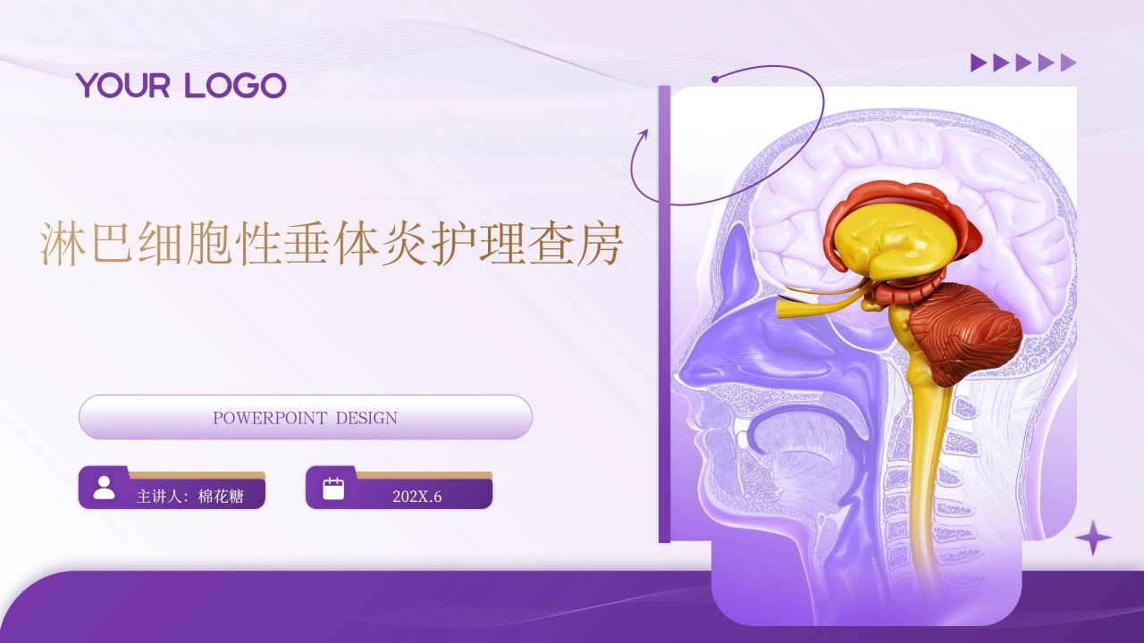 C586淋巴细胞性垂体炎护理查房带参考文献PPT-白衣资料网