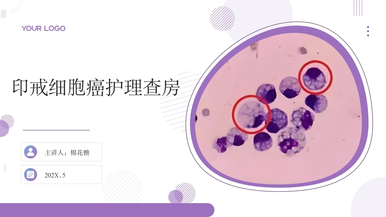 C588印戒细胞癌护理查房带参考文献PPT-白衣资料网