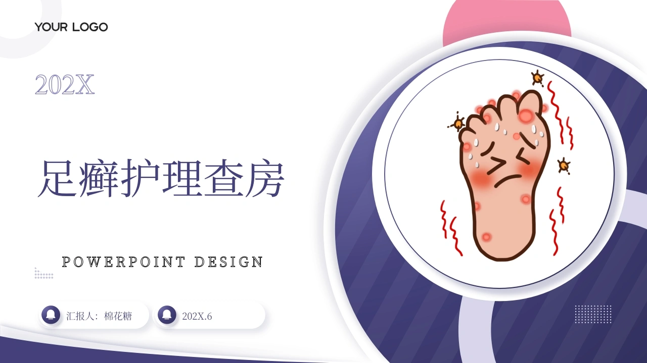 C621足癣护理查房带参考文献PPT