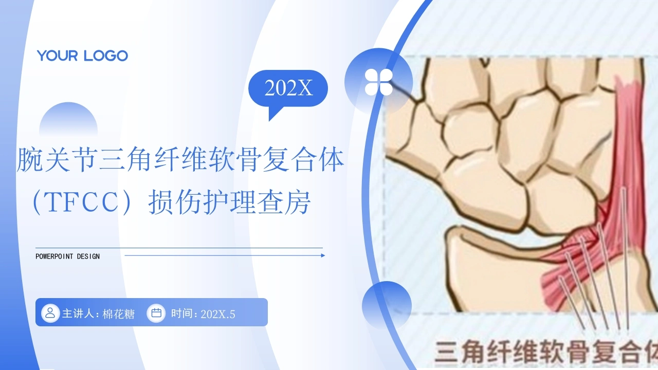 C623腕关节三角纤维软骨复合体（TFCC）损伤护理查房带参考文献PPT