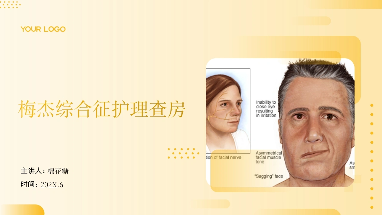C648梅杰综合征护理查房带参考文献PPT