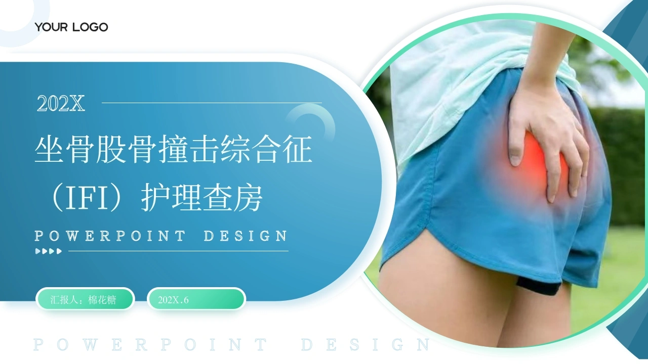 C655坐骨股骨撞击综合征（IFI）护理查房带参考文献PPT