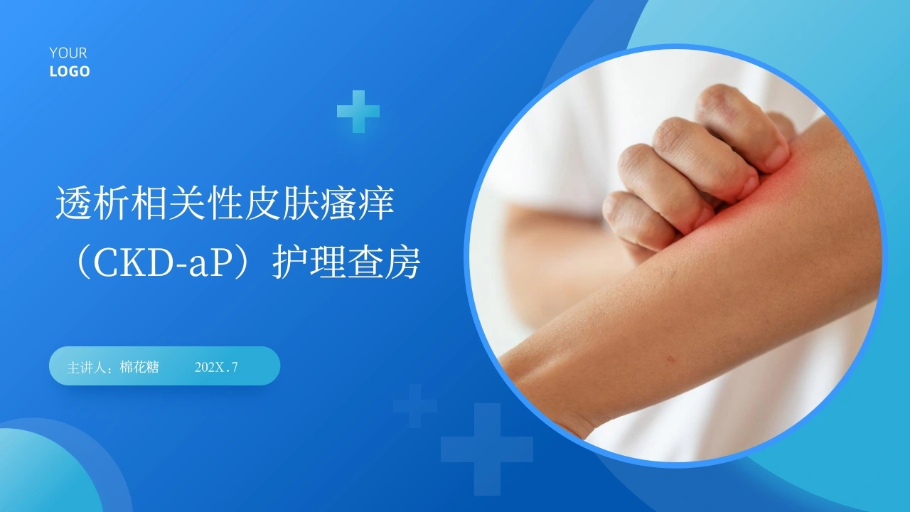 C662透析相关性皮肤瘙痒（CKD-aP）护理查房带参考文献PPT-白衣资料网
