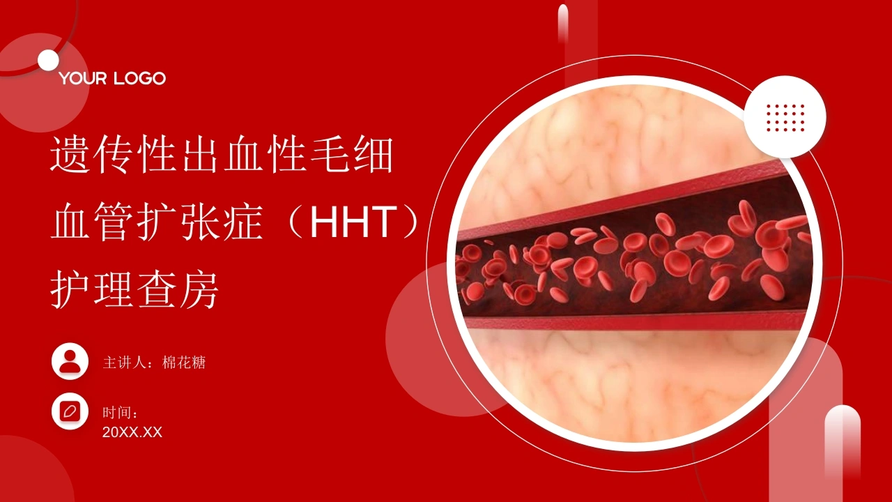 C671遗传性出血性毛细血管扩张症（HHT）护理查房带参考文献PPT-白衣资料网