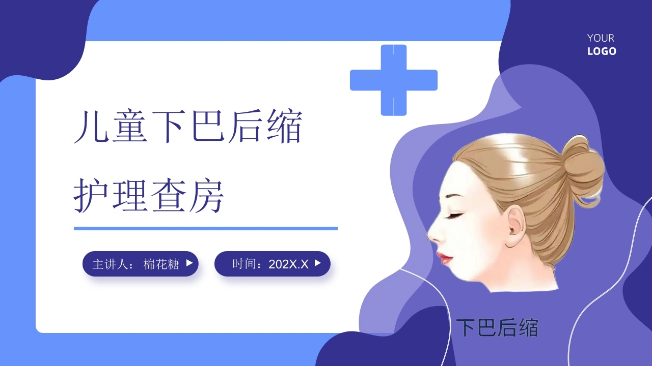 C673儿童下巴后缩护理查房带参考文献PPT