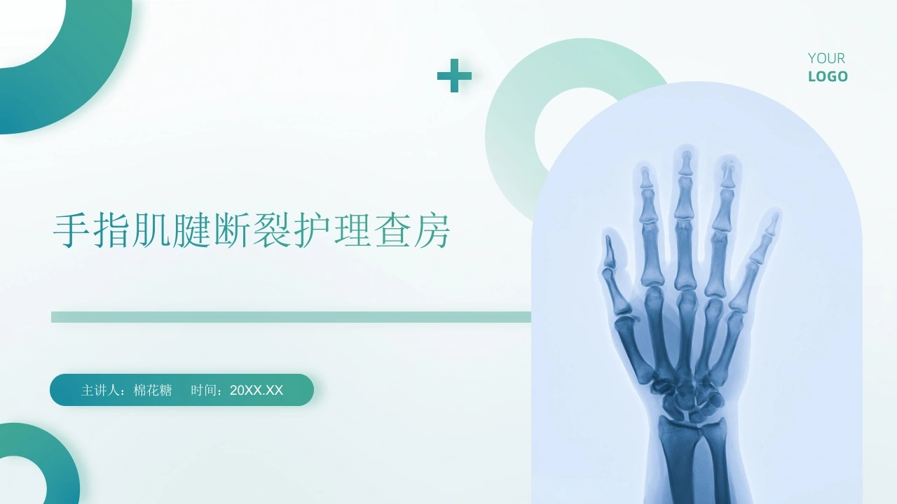 C676手指肌腱断裂护理查房带参考文献PPT