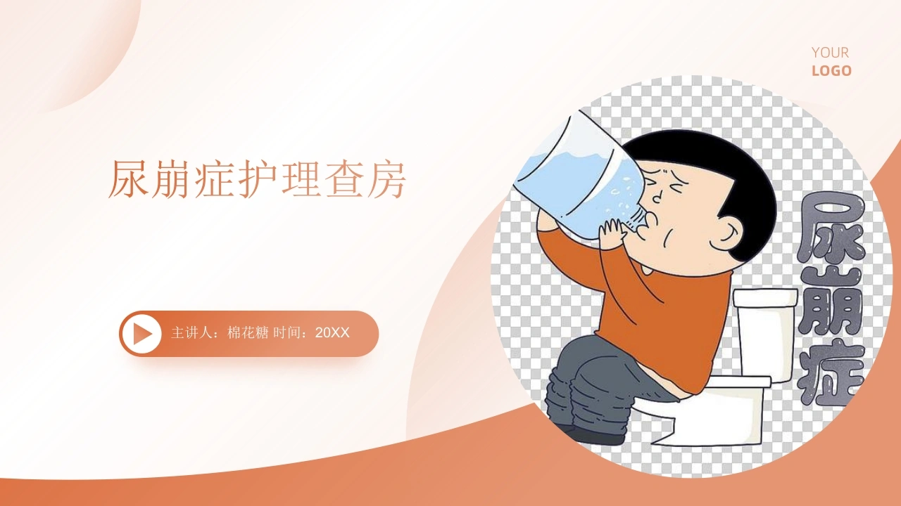 C684尿崩症护理查房带参考文献PPT
