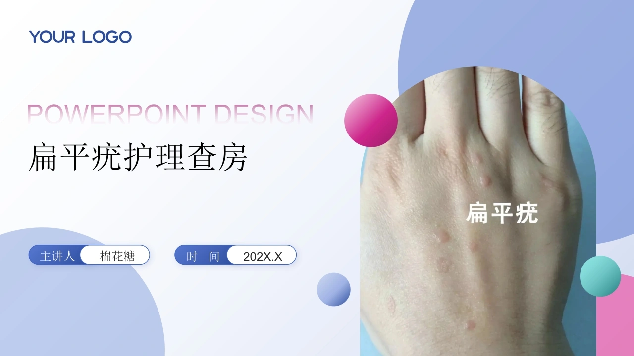 C690扁平疣护理查房带参考文献PPT