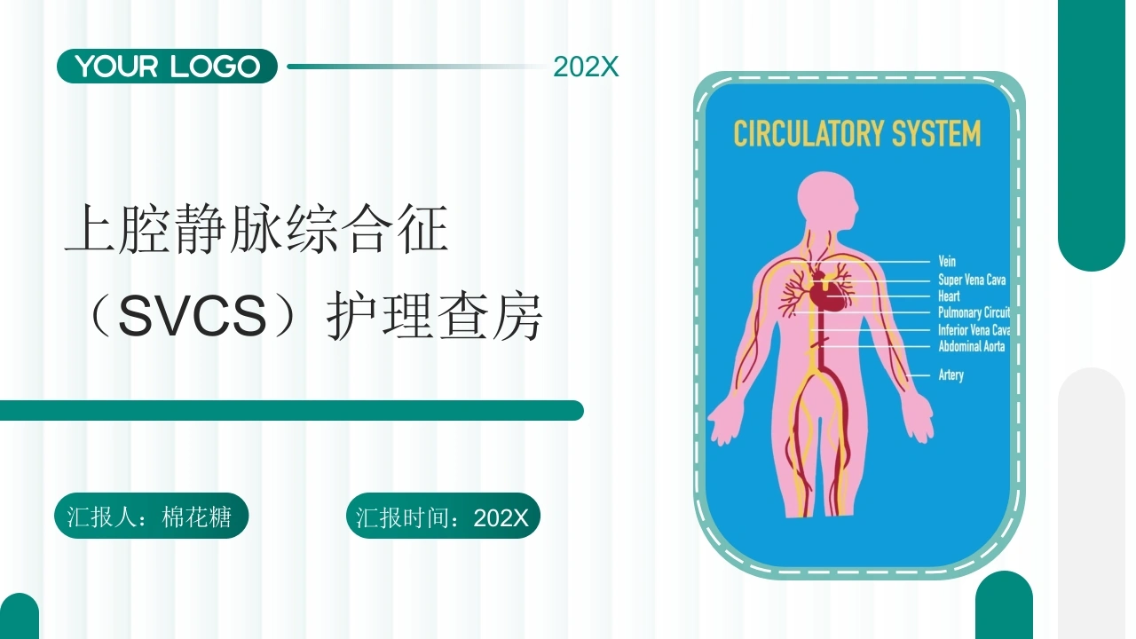 C696上腔静脉综合征（SVCS）护理查房带参考文献PPT