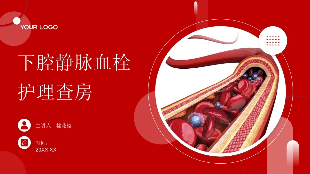 C701下腔静脉血栓护理查房带参考文献PPT