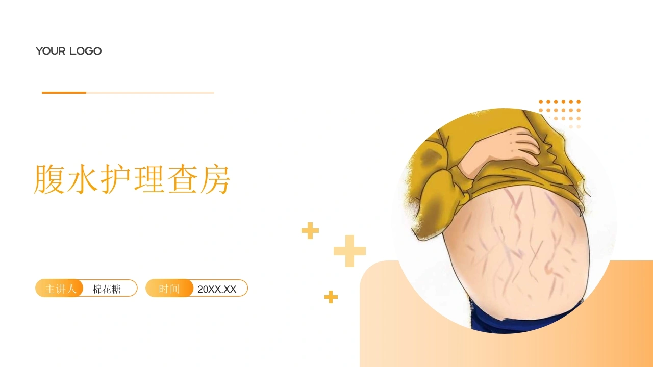 C703腹水护理查房带参考文献PPT-白衣资料网