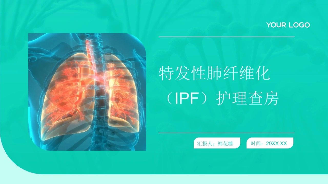 C708特发性肺纤维化IPF护理查房带参考文献PPT-白衣资料网