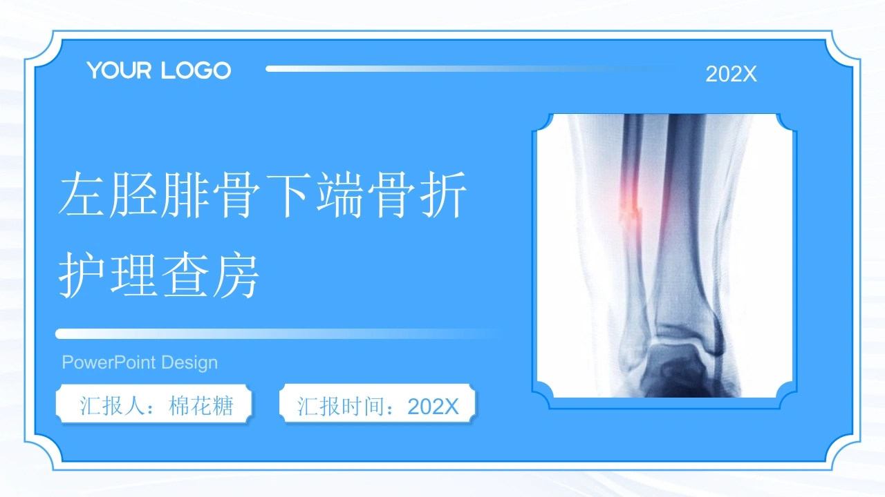 C713左胫腓骨下端骨折护理查房带参考文献PPT-白衣资料网