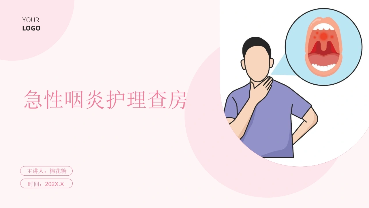 C715急性咽炎护理查房带参考文献PPT