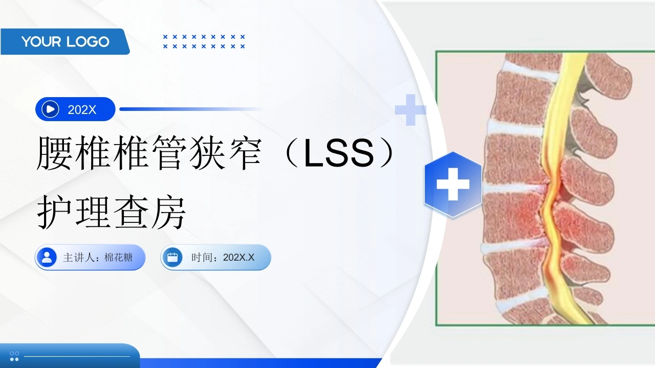 C717腰椎椎管狭窄（LSS）护理查房带参考文献PPT