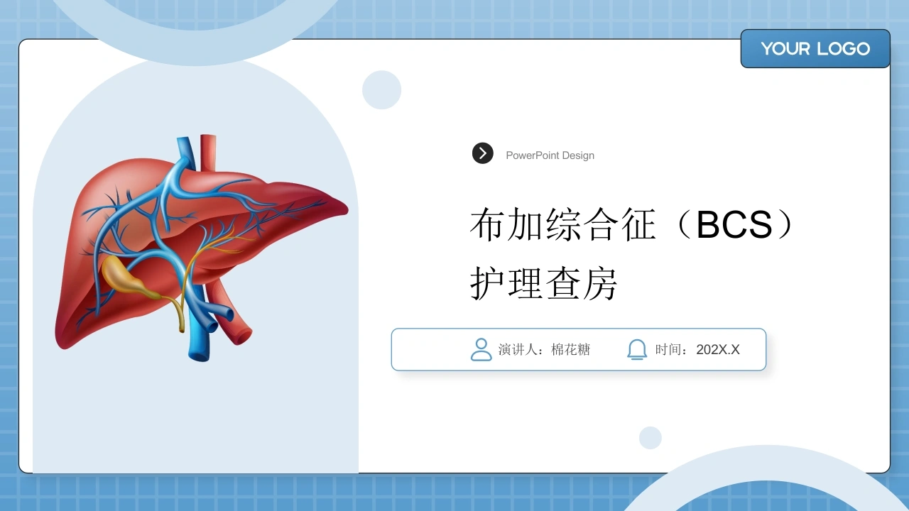 C736布加综合征（BCS）护理查房带参考文献PPT