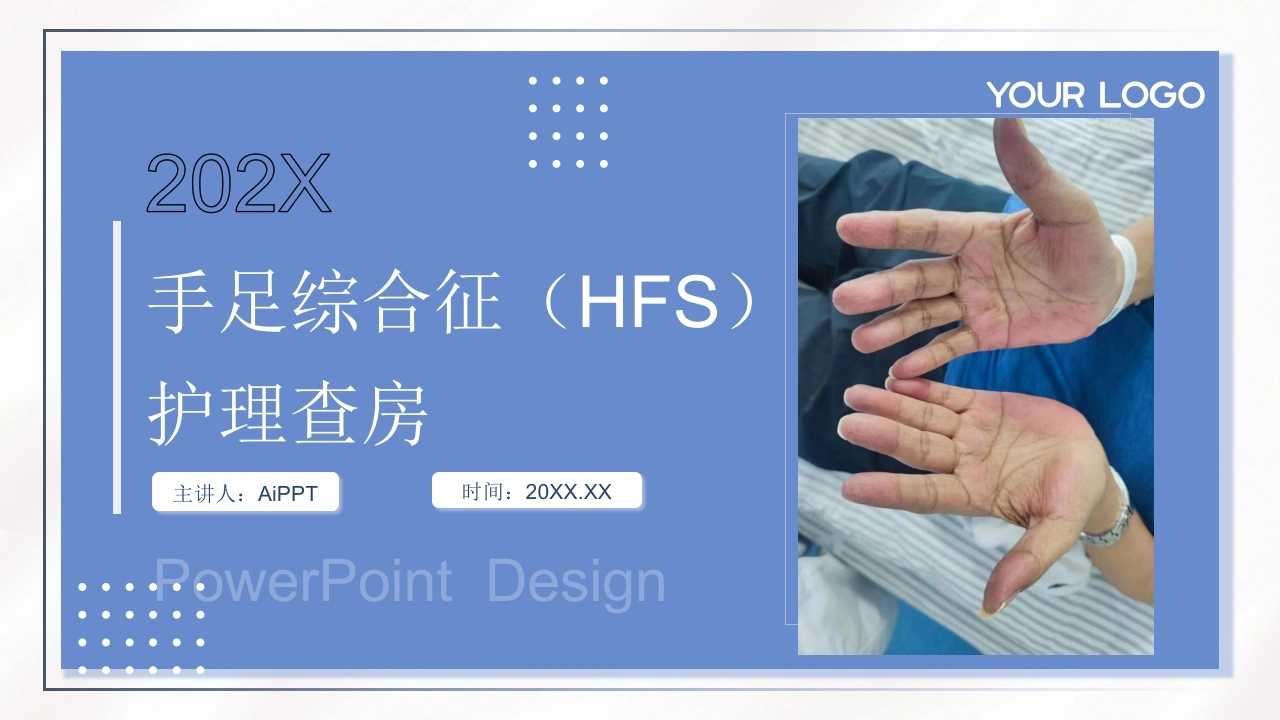 C742手足综合征（HFS）护理查房带参考文献PPT