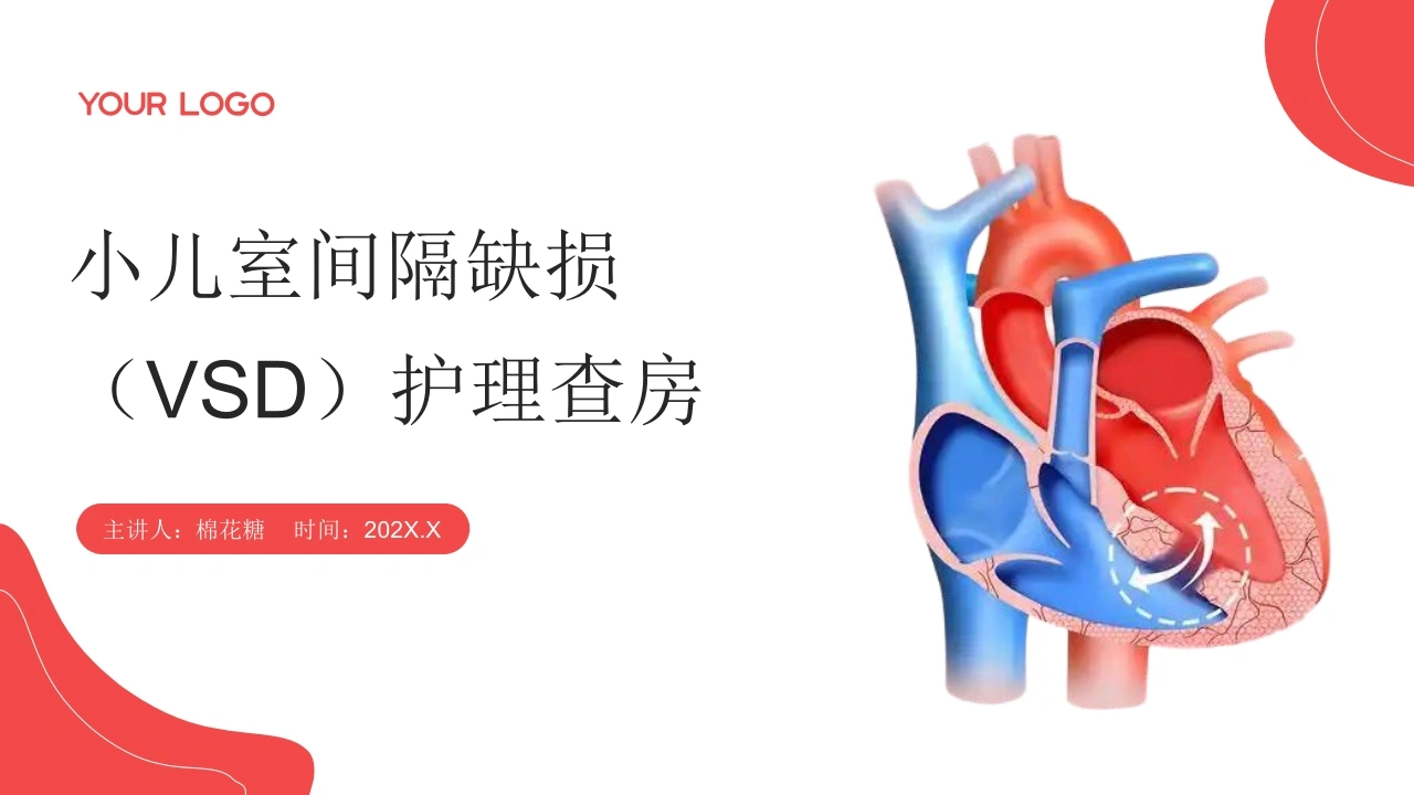 C754小儿室间隔缺损（VSD）护理查房带参考文献PPT