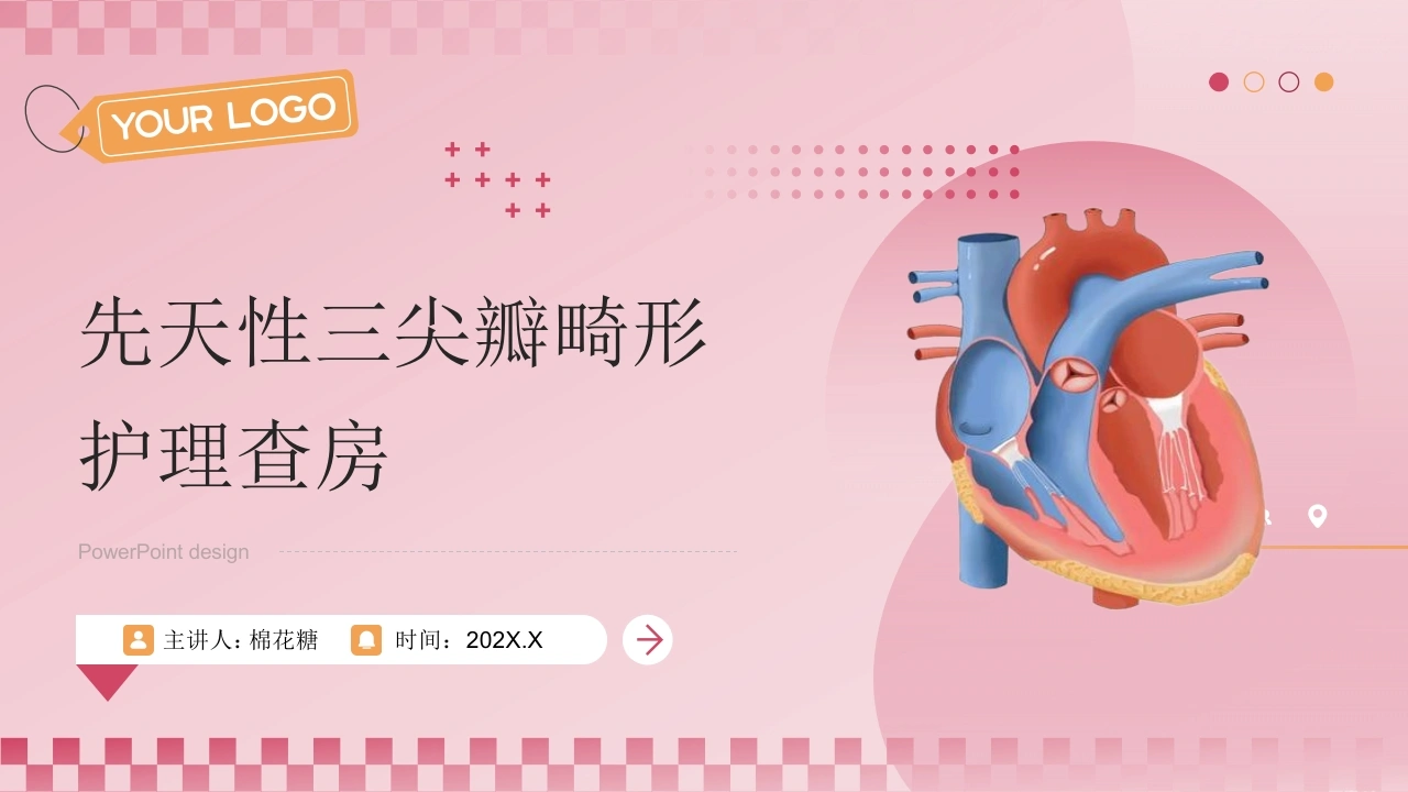 C764先天性三尖瓣畸形护理查房带参考文献PPT-白衣资料网