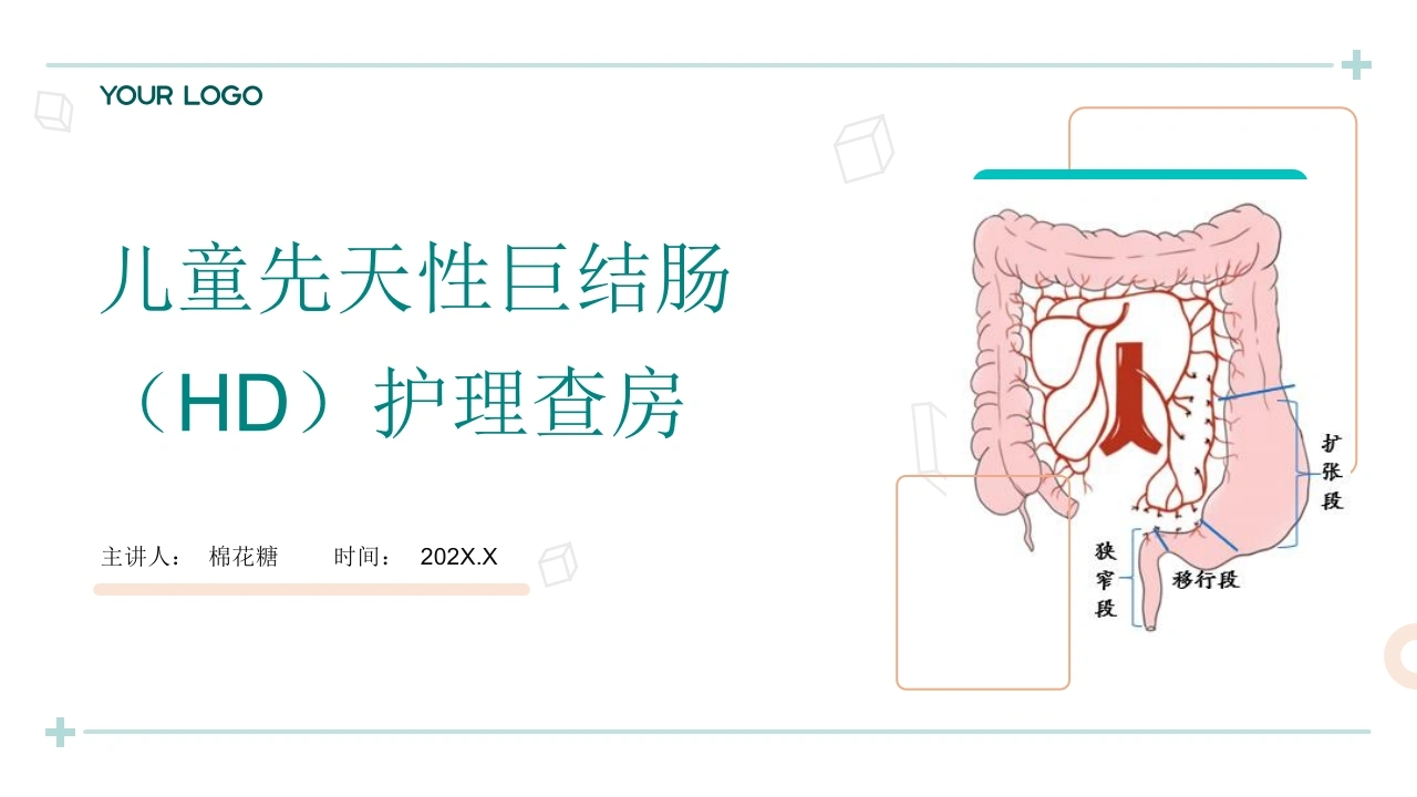 C768儿童先天性巨结肠（HD）护理查房带参考文献PPT