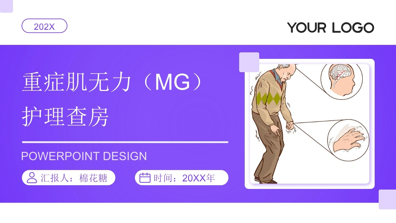 C773重症肌无力（MG）护理查房带参考文献PPT-白衣资料网
