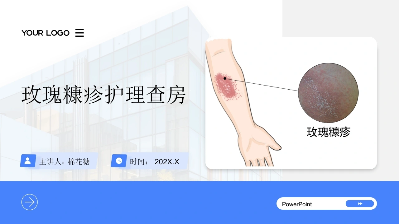 C774玫瑰糠疹护理查房带参考文献PPT