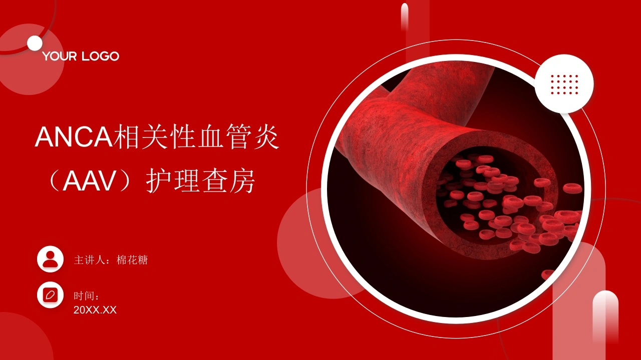 C779ANCA相关性血管炎（AAV）护理查房带参考文献PPT