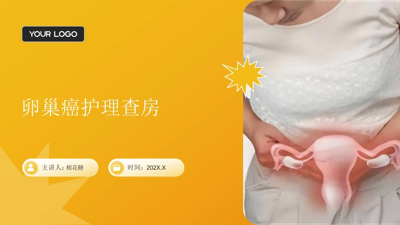 C786卵巢癌护理查房带参考文献PPT