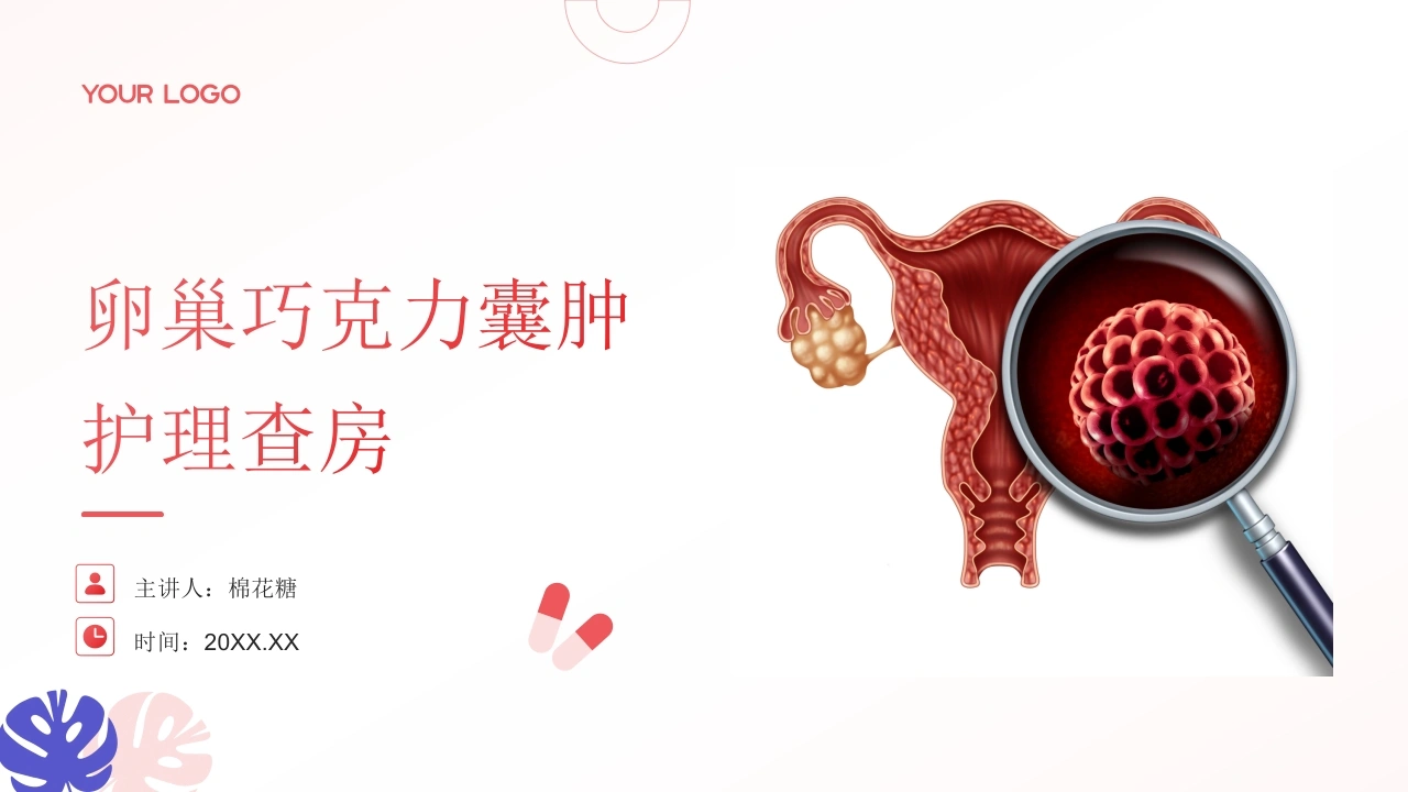 C794卵巢巧克力囊肿护理查房带参考文献PPT
