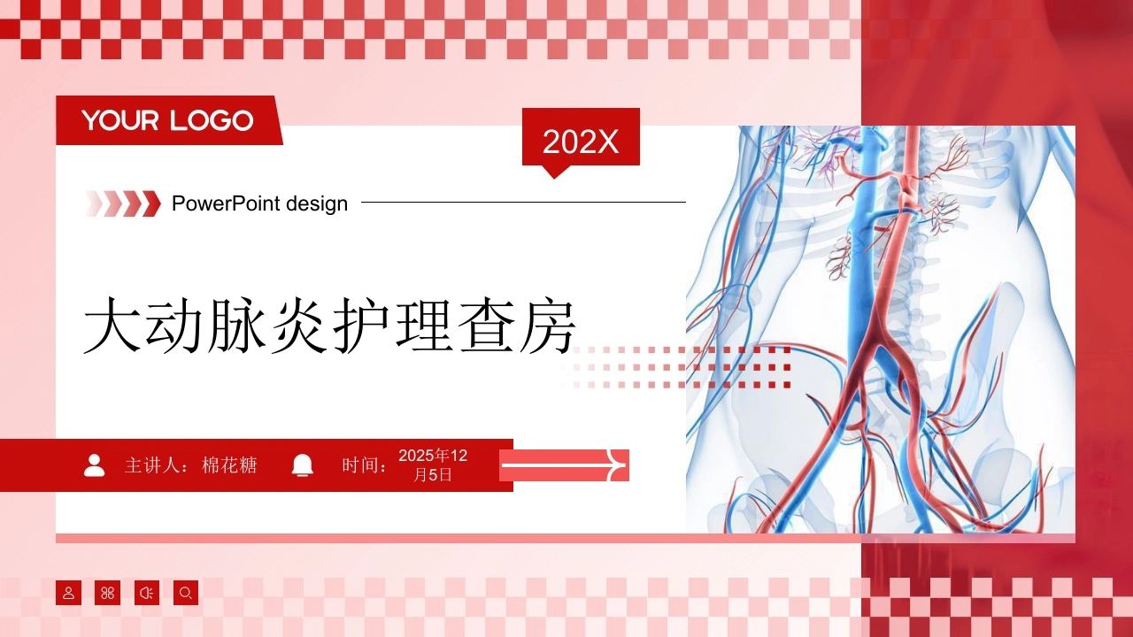 C800大动脉炎护理查房带参考文献PPT