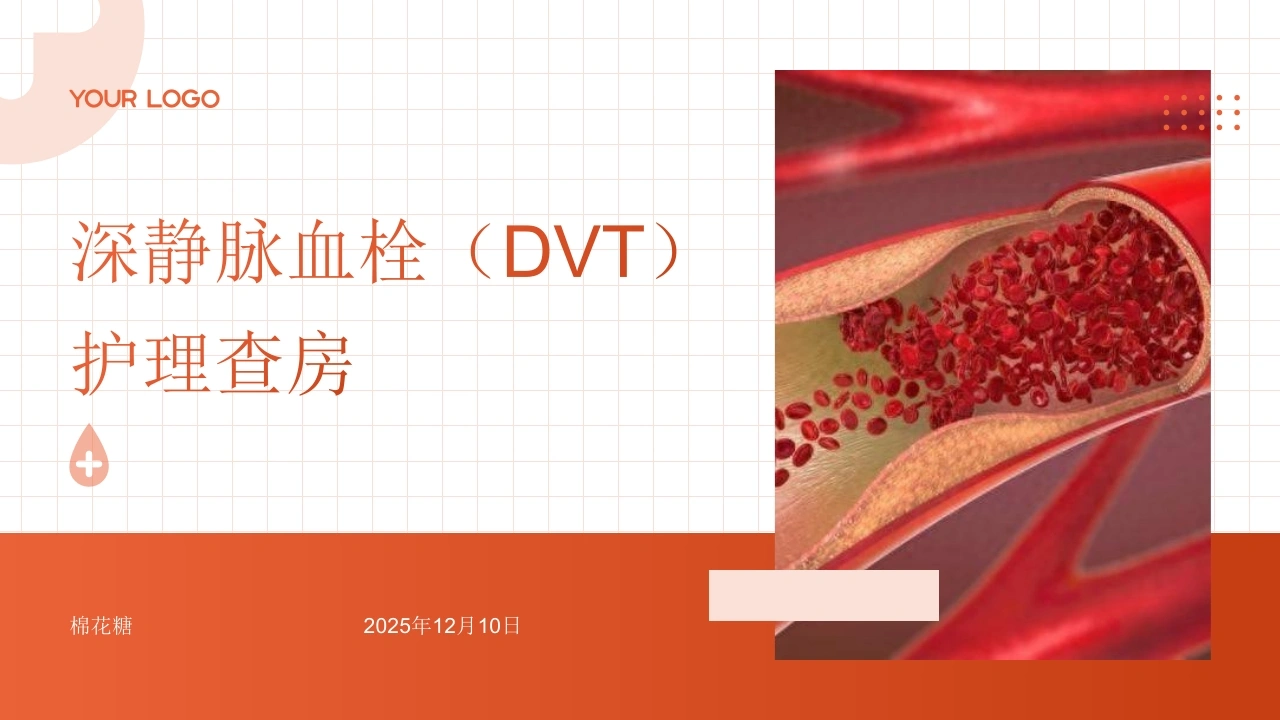 C804深静脉血栓（DVT）护理查房带参考文献PPT