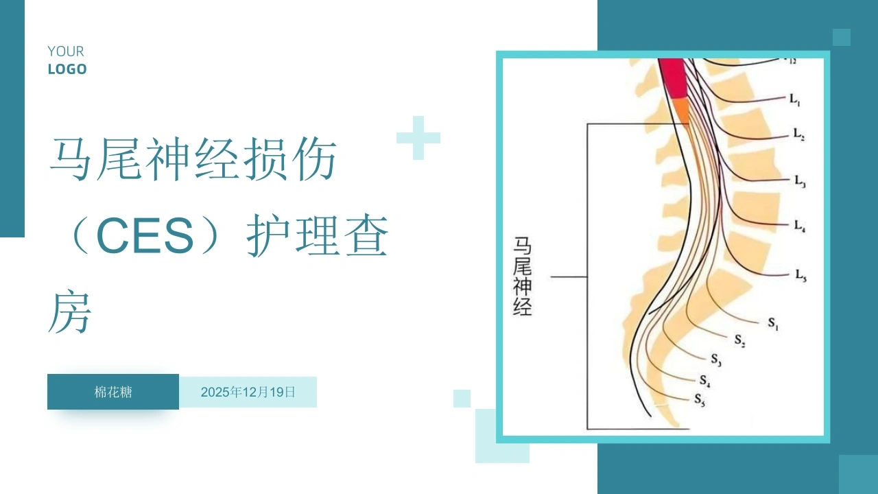 C815马尾神经损伤（CES）护理查房带参考文献PPT