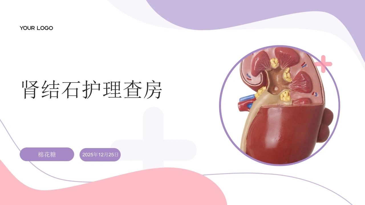 C821肾结石护理查房带参考文献PPT-白衣资料网