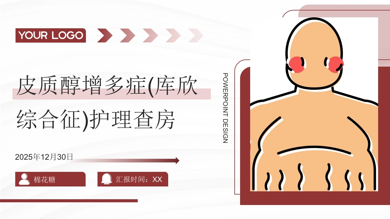 C825皮质醇增多症(库欣综合征)护理查房带参考文献PPT