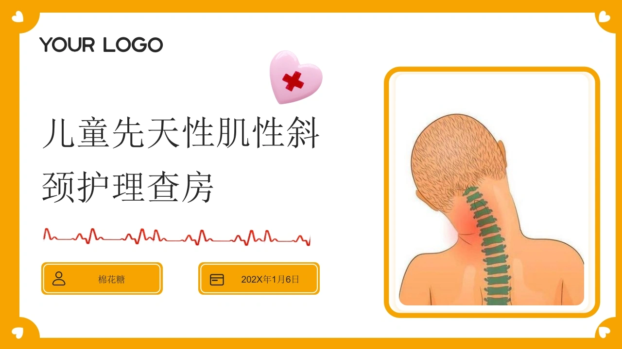 C832儿童先天性肌性斜颈护理查房带参考文献PPT
