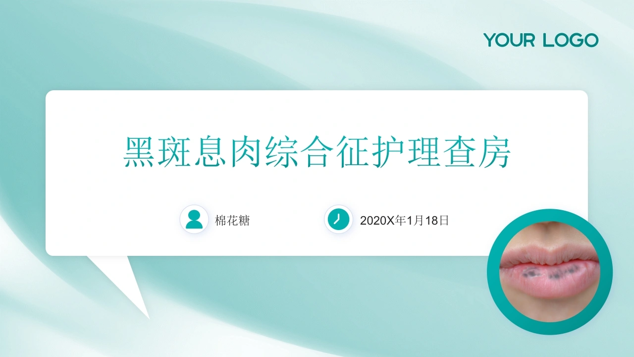 C846黑斑息肉综合征护理查房带参考文献PPT