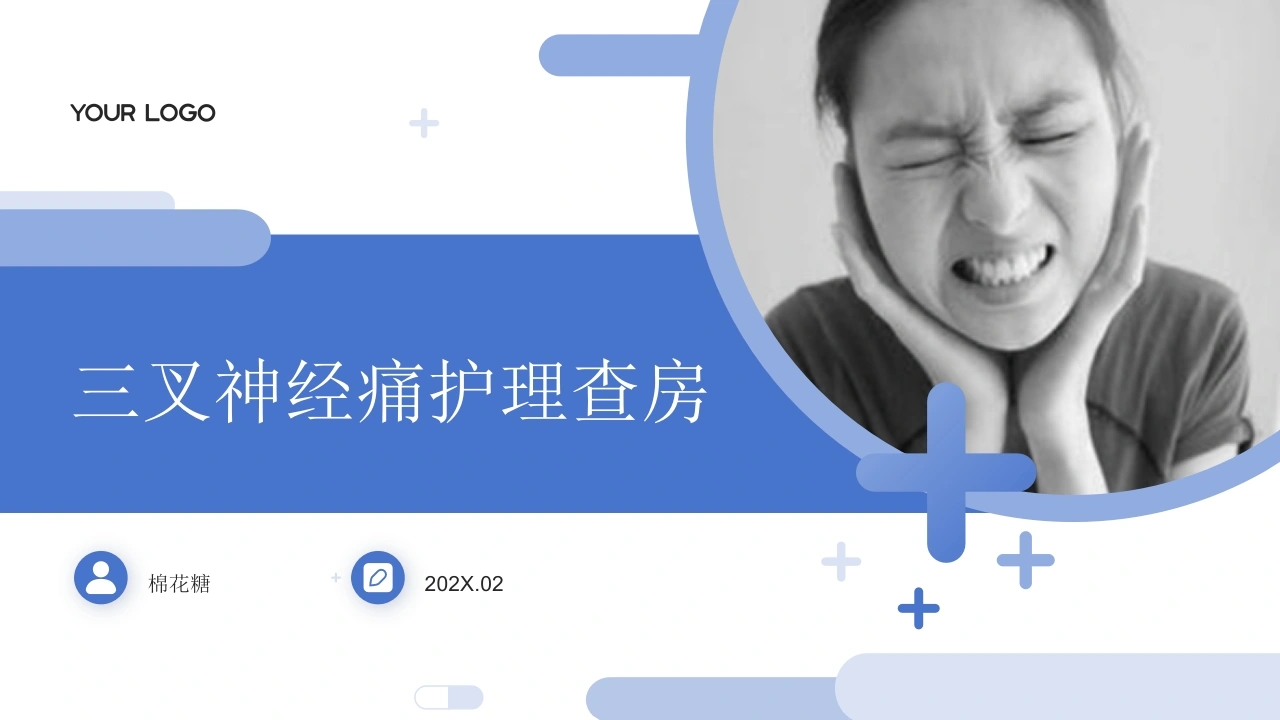 C867三叉神经痛护理查房带参考文献PPT