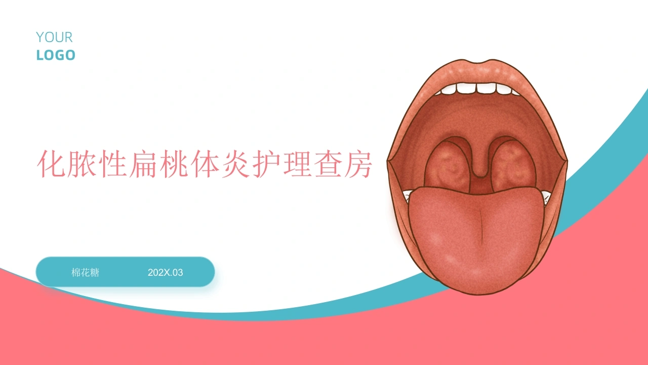 C887化脓性扁桃体炎护理查房带参考文献PPT