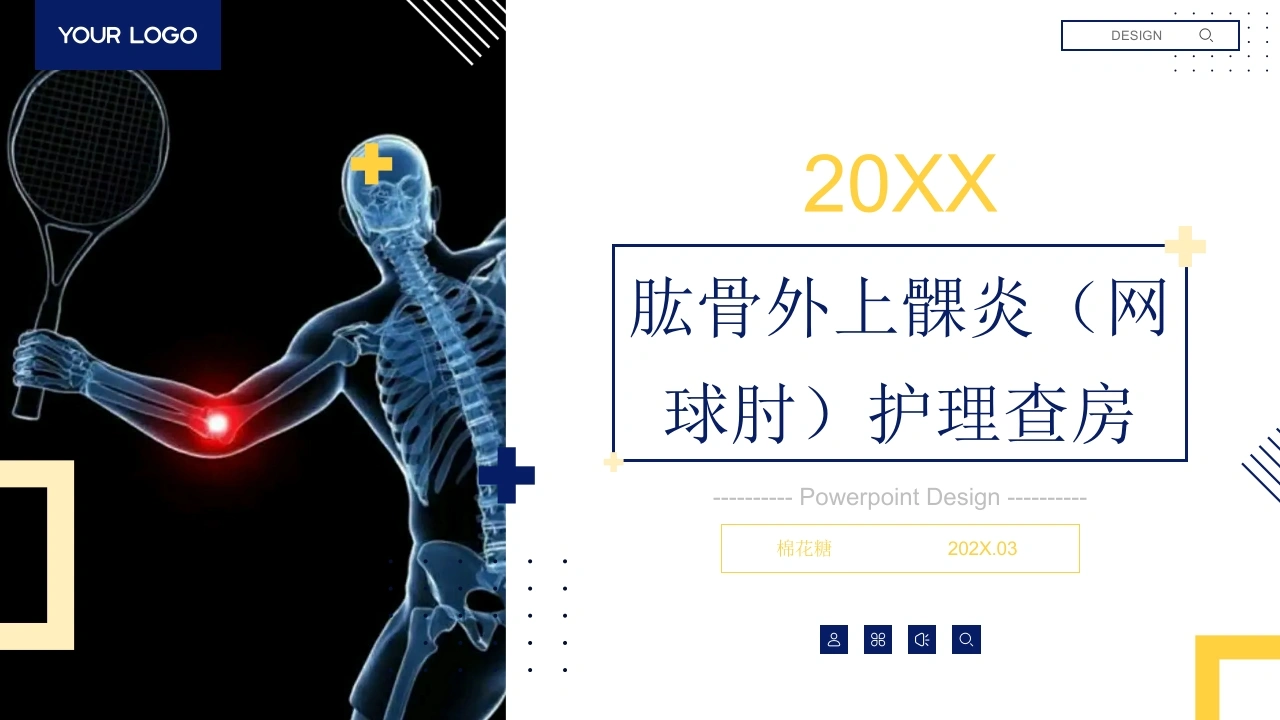 C888肱骨外上髁炎（网球肘）护理查房带参考文献PPT