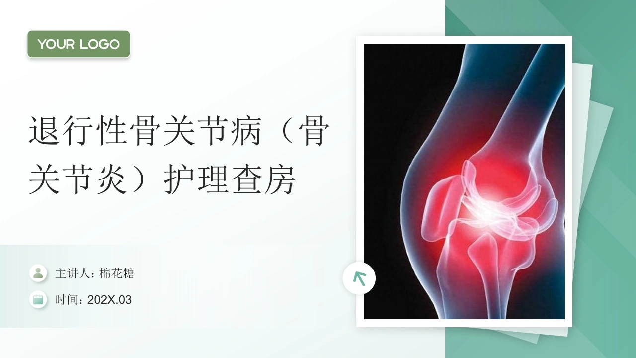 C889退行性骨关节病（骨关节炎）护理查房带参考文献PPT-白衣资料网