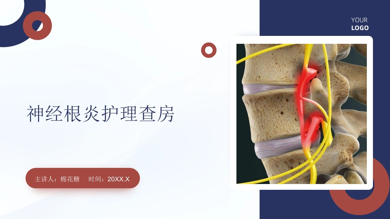 C890神经根炎护理查房带参考文献PPT