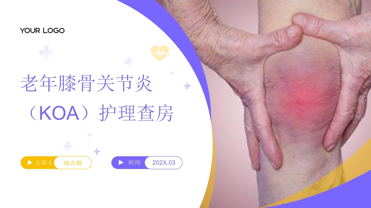 C891老年膝骨关节炎（KOA）护理查房带参考文献PPT