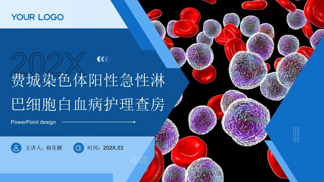 C892费城染色体阳性急性淋巴细胞白血病护理查房带参考文献PPT-白衣资料网